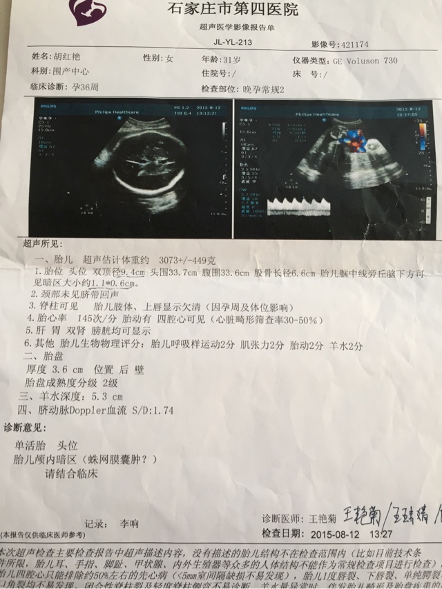 美国木地板零售商LL.US)亏损|华体会体育hth官方网站(图1) hth官网入口